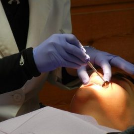 What Is The Need For Teeth Whitening?