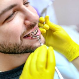 Orthodontic Ballarat: Transforming Smiles With Expert Care